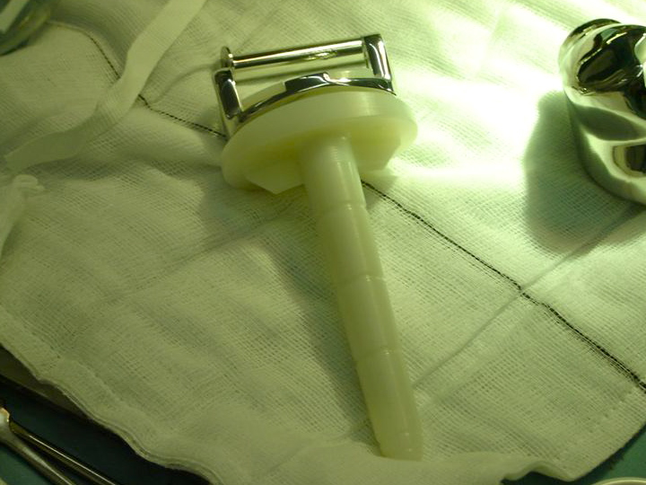 Assembled tibial hinge